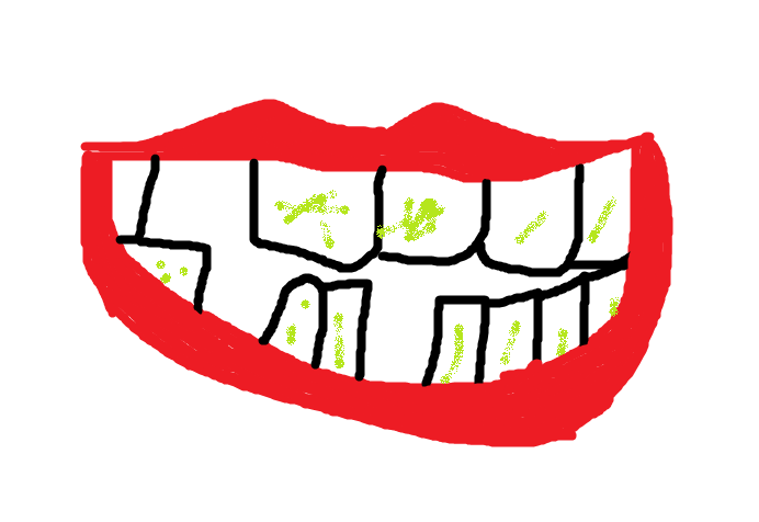 unbrushed teeth
